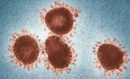 Coronavirus (COVID-19) image. Photo by CDC on Unsplash. 2020